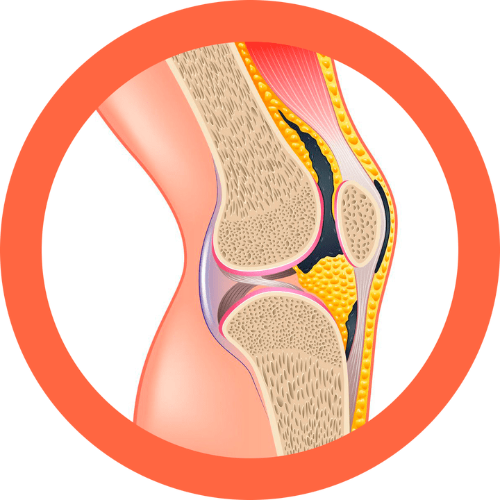 Hondroten restaura las articulaciones y los músculos.
