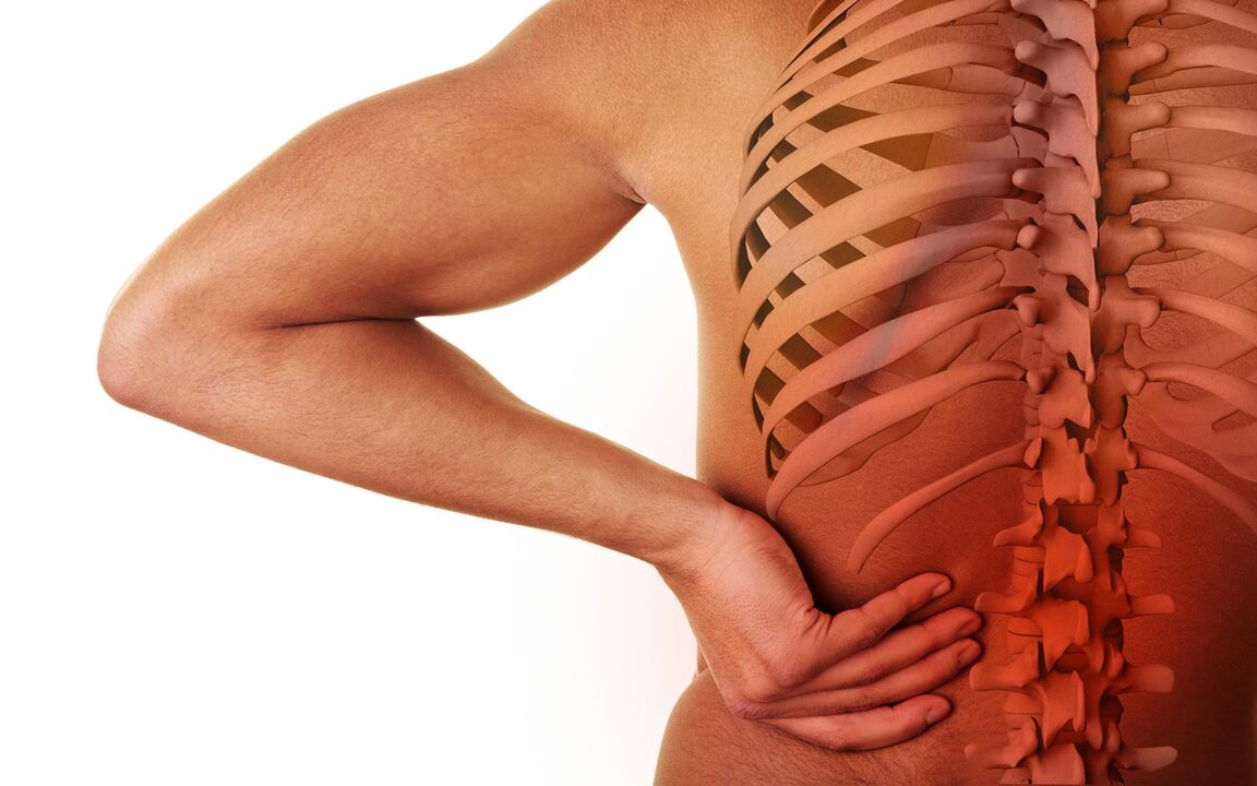 síntomas de osteocondrosis lumbar